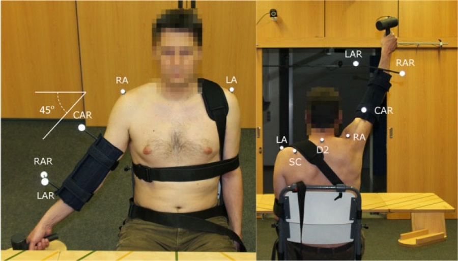 Dynamic thoracohumeral kinematics are dependent upon the etiology of the shoulder injury