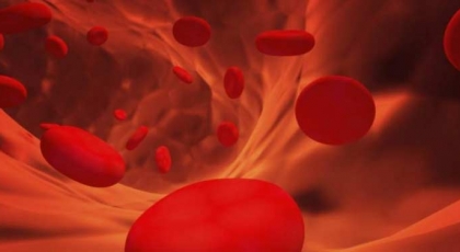 Exposici�n ocupacional a agentes qu�micos y neoplasias hematol�gicas