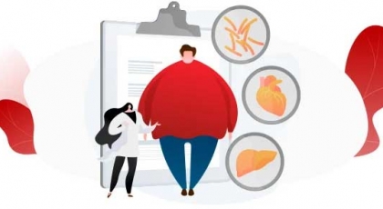 Posicionamiento del m�dico del trabajo en obesidad.